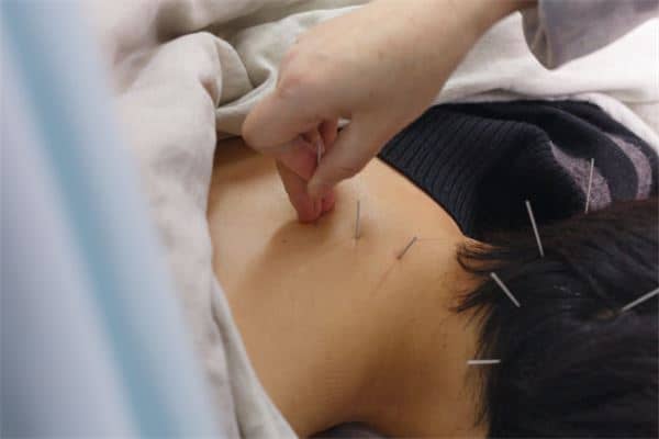 梦见针灸是什么意思