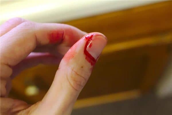 已婚女人梦见手指流血是什么意思