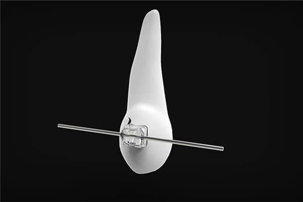 梦到梦掉牙齿预示了什么