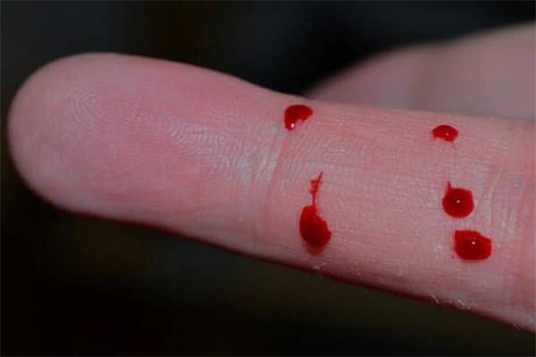 梦到被蛇咬流血代表着什么?