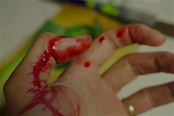 梦见自己被蛇咬伤会怎么样